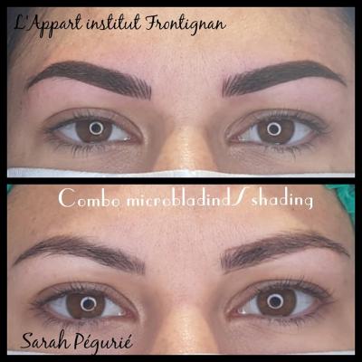 Photos Micro/Dermo sourcils