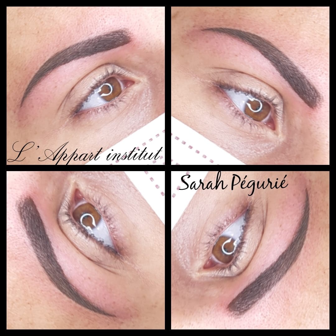 Dermo PIGMENTATION