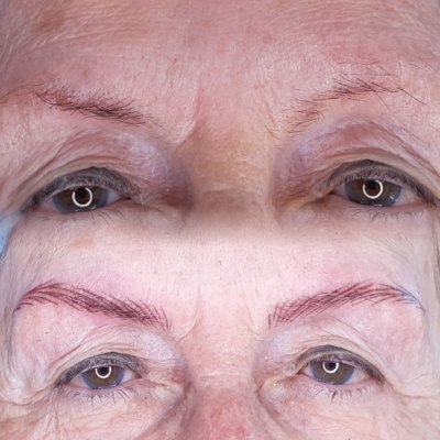 Nanobrow
